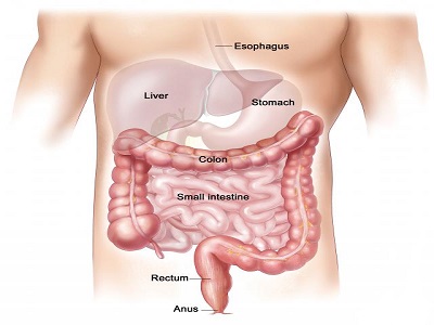 Colon and Rectal Cancer